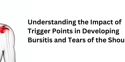Understanding The Impact of Trigger Points on Shoulder Injury