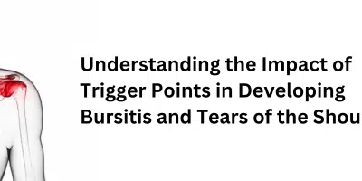 Understanding The Impact of Trigger Points on Shoulder Injury