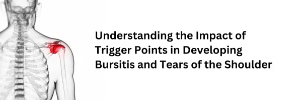 Understanding The Impact of Trigger Points on Shoulder Injury